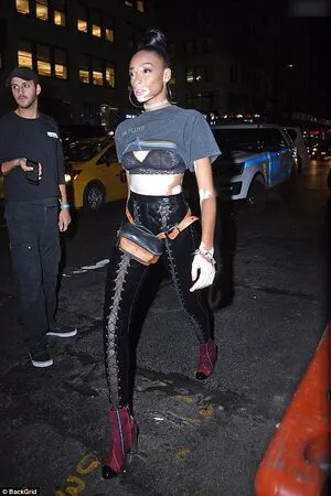 Winnie Harlow OnlyFans Leaked Free Thumbnail Picture - #JJXtaD9vvs