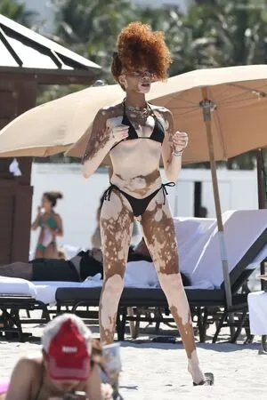 Winnie Harlow OnlyFans Leaked Free Thumbnail Picture - #JKS4Hrlt4F