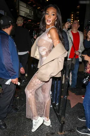 Winnie Harlow OnlyFans Leaked Free Thumbnail Picture - #JPgLKhXdmp