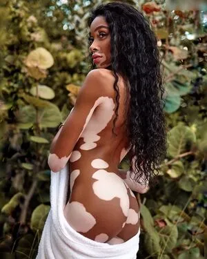 Winnie Harlow OnlyFans Leaked Free Thumbnail Picture - #JQwyxGIjzu