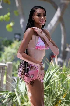 Winnie Harlow OnlyFans Leaked Free Thumbnail Picture - #JcWER778BK