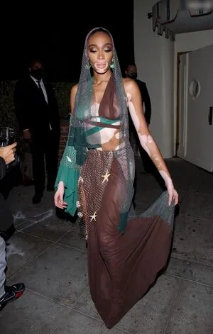 Winnie Harlow OnlyFans Leaked Free Thumbnail Picture - #Jml0gjzbvA