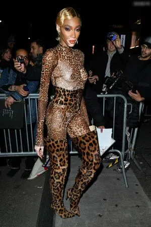 Winnie Harlow OnlyFans Leaked Free Thumbnail Picture - #K3XdnGrjIu