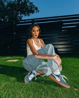 Winnie Harlow OnlyFans Leaked Free Thumbnail Picture - #KllwHn8xGT