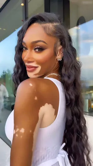 Winnie Harlow OnlyFans Leaked Free Thumbnail Picture - #L25PBF1lww