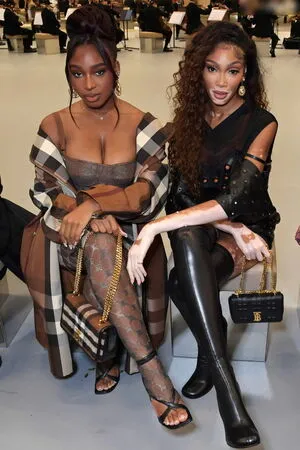 Winnie Harlow OnlyFans Leaked Free Thumbnail Picture - #LXXXBtuNUJ