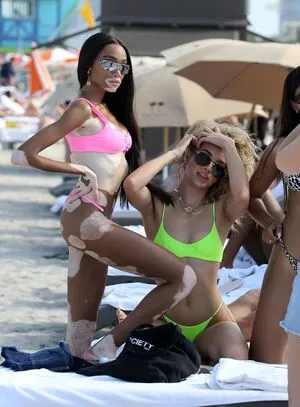 Winnie Harlow OnlyFans Leaked Free Thumbnail Picture - #LZym0DIkTh