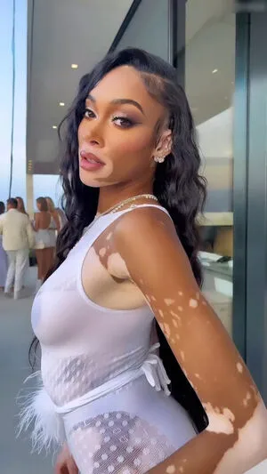 Winnie Harlow OnlyFans Leaked Free Thumbnail Picture - #Lt9UFiEiEM