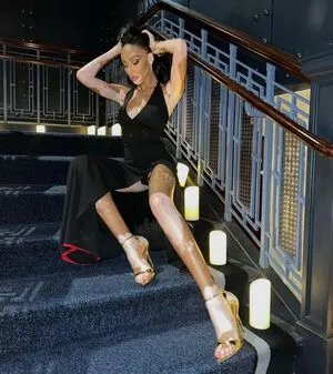 Winnie Harlow OnlyFans Leaked Free Thumbnail Picture - #M1DSlQo8rT