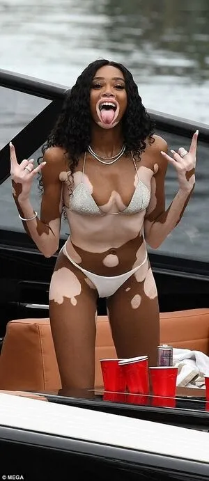 Winnie Harlow OnlyFans Leaked Free Thumbnail Picture - #M2WcbG4xhs