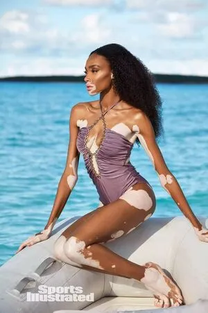 Winnie Harlow OnlyFans Leaked Free Thumbnail Picture - #MCneOiG2tb