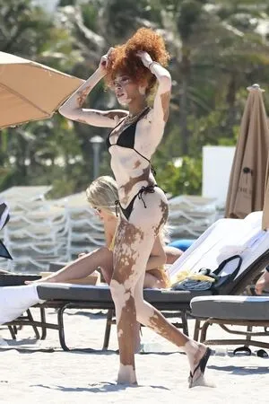 Winnie Harlow OnlyFans Leaked Free Thumbnail Picture - #MIxFeTrHRJ