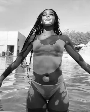 Winnie Harlow OnlyFans Leaked Free Thumbnail Picture - #MfVKAyzULq