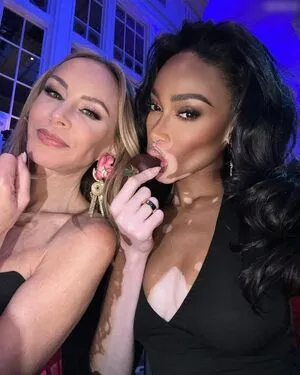 Winnie Harlow OnlyFans Leaked Free Thumbnail Picture - #Mk9mUqiins