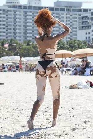 Winnie Harlow OnlyFans Leaked Free Thumbnail Picture - #MlSEoAlxYk