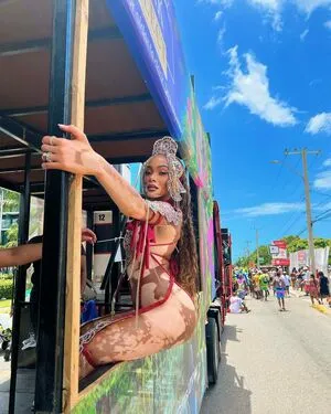 Winnie Harlow OnlyFans Leaked Free Thumbnail Picture - #MlyxXtzb7X