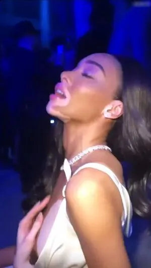 Winnie Harlow OnlyFans Leaked Free Thumbnail Picture - #NAmCCMJGmN