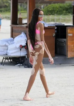 Winnie Harlow OnlyFans Leaked Free Thumbnail Picture - #NjvVIIdvcS