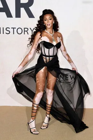 Winnie Harlow OnlyFans Leaked Free Thumbnail Picture - #Nu09gDNXQe