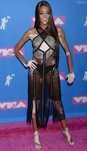 Winnie Harlow OnlyFans Leaked Free Thumbnail Picture - #OHZTi05km6