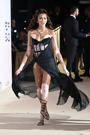 Winnie Harlow OnlyFans Leaked Free Thumbnail Picture - #OTSkOjataY
