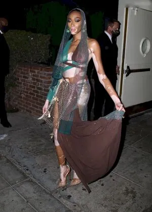 Winnie Harlow OnlyFans Leaked Free Thumbnail Picture - #QELwfbkrp1