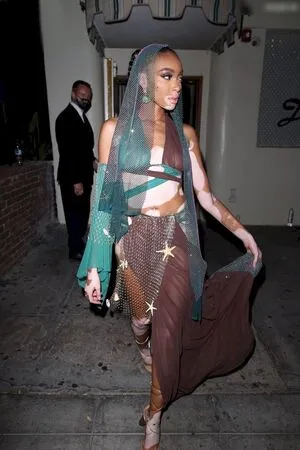 Winnie Harlow OnlyFans Leaked Free Thumbnail Picture - #QYToGYxEkL