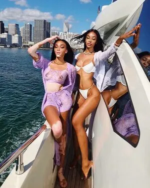 Winnie Harlow OnlyFans Leaked Free Thumbnail Picture - #QgkU1DuEJW