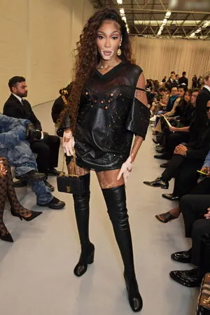 Winnie Harlow OnlyFans Leaked Free Thumbnail Picture - #RKsodB217N