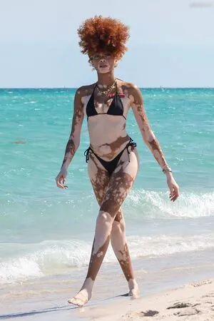 Winnie Harlow OnlyFans Leaked Free Thumbnail Picture - #Rf2OZlVyh7