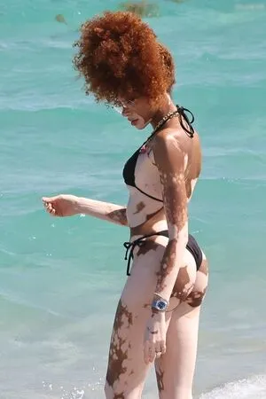 Winnie Harlow OnlyFans Leaked Free Thumbnail Picture - #RqoSIxdZl5