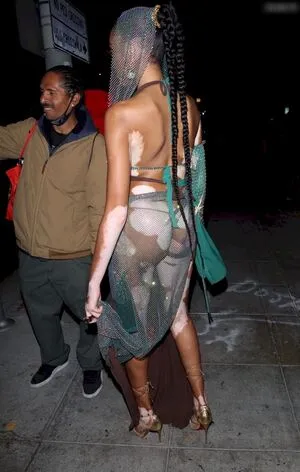 Winnie Harlow OnlyFans Leaked Free Thumbnail Picture - #Rsrfdz2xkD