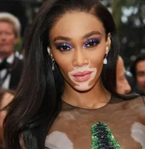 Winnie Harlow OnlyFans Leaked Free Thumbnail Picture - #RwsyULuxeY