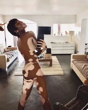 Winnie Harlow OnlyFans Leaked Free Thumbnail Picture - #SDsjFEDYae