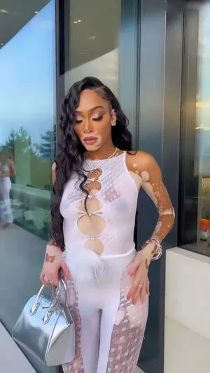 Winnie Harlow OnlyFans Leaked Free Thumbnail Picture - #STwPQaRSCw