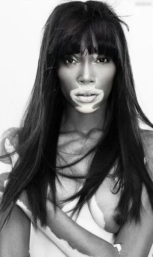 Winnie Harlow OnlyFans Leaked Free Thumbnail Picture - #ShVHaLljrv