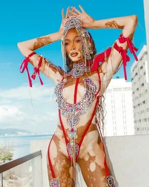 Winnie Harlow OnlyFans Leaked Free Thumbnail Picture - #StgG2w7YET