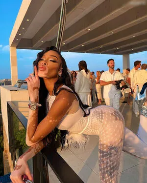 Winnie Harlow OnlyFans Leaked Free Thumbnail Picture - #SudInQov8A