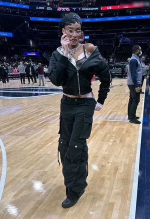 Winnie Harlow OnlyFans Leaked Free Thumbnail Picture - #THUUuLMPX7