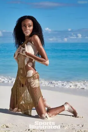 Winnie Harlow OnlyFans Leaked Free Thumbnail Picture - #TLNApx9Sf1
