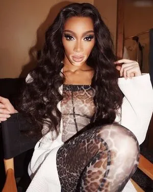 Winnie Harlow OnlyFans Leaked Free Thumbnail Picture - #Tbo2fEx2HP