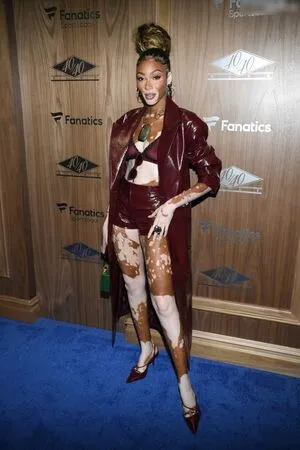 Winnie Harlow OnlyFans Leaked Free Thumbnail Picture - #Tk4wZyuVzC