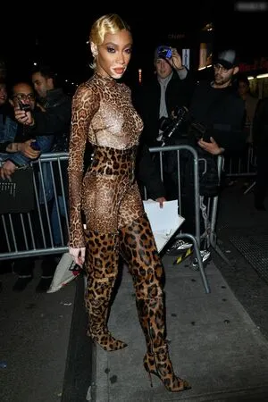 Winnie Harlow OnlyFans Leaked Free Thumbnail Picture - #TwEgUS0XQ0