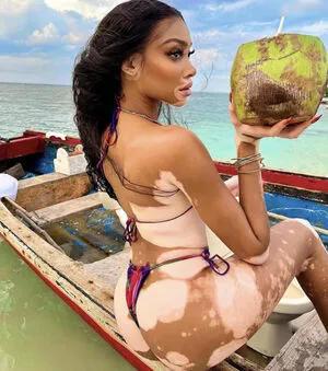 Winnie Harlow OnlyFans Leaked Free Thumbnail Picture - #U8mb6uvYVW