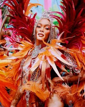 Winnie Harlow OnlyFans Leaked Free Thumbnail Picture - #UHbcjSnsKB