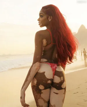 Winnie Harlow OnlyFans Leaked Free Thumbnail Picture - #UoNXekMtPW