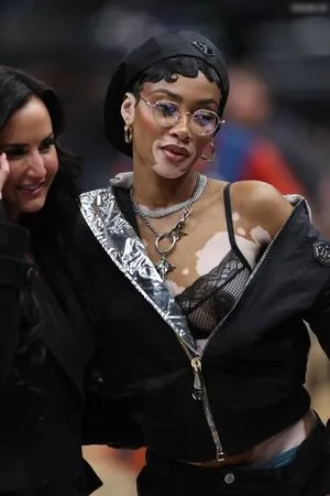 Winnie Harlow OnlyFans Leaked Free Thumbnail Picture - #UuHUyi4KoC