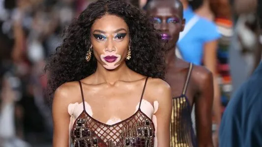Winnie Harlow OnlyFans Leaked Free Thumbnail Picture - #UuS1vJgAeO