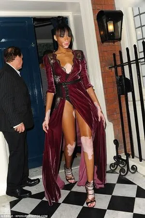 Winnie Harlow OnlyFans Leaked Free Thumbnail Picture - #VKccyyT4tt