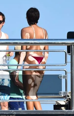 Winnie Harlow OnlyFans Leaked Free Thumbnail Picture - #VwNFm0rD5O